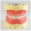 24pcs Removable Teeth Children Standard Dental Model 13003